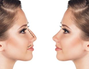 شرایط جراحی بینی