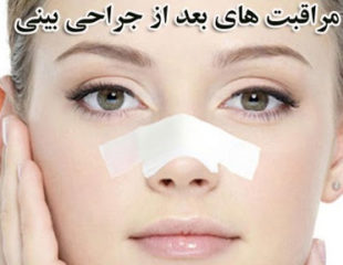 مراقبت های بعد از عمل بینی