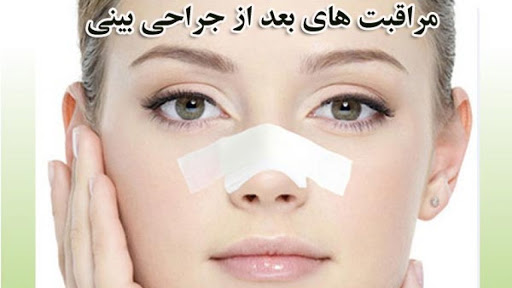 مراقبت های بعد از عمل بینی