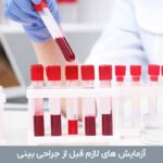 آزمایش های قبل از جراحی بینی