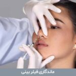 ماندگاری فیلر بینی