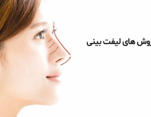 روش های لیفت بینی