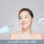 مراقبت های بعد از فیلر بینی