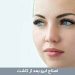 اصلاح ابرو بعد از کاشت