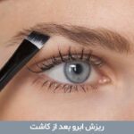 ریزش ابرو بعد از کاشت
