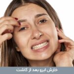 خارش ابرو بعد از کاشت