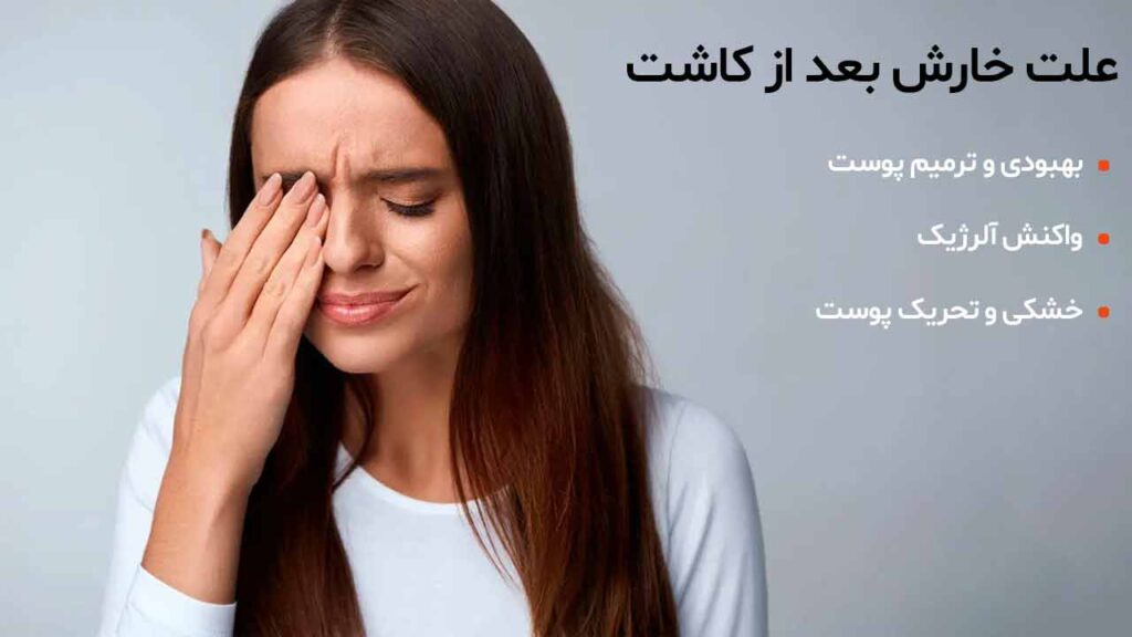 علت خارش بعد از کاشت ابرو