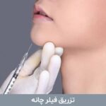 تزریق فیلر چانه