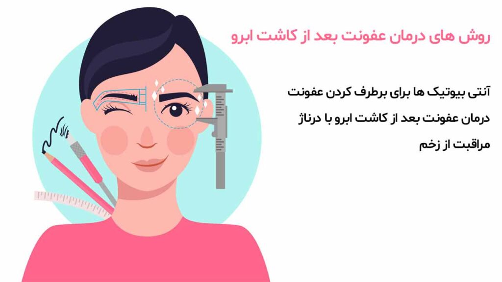 روش های درمان عفونت بعد از کاشت ابرو