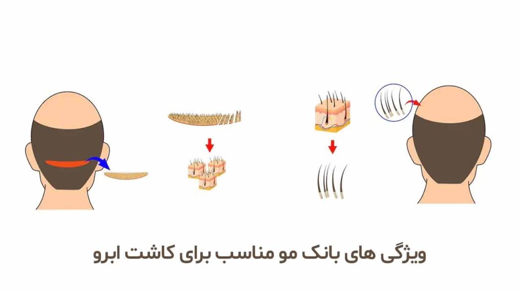 ویژگی های بانک مو مناسب برای کاشت ابرو